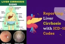 liver cirrhosis icd 10
